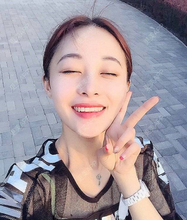 更美 - 更美用户QdDTwC5kly的淡化皱纹经验 | 淡化皱纹 | 注射除皱针打鱼尾纹 | 杭州