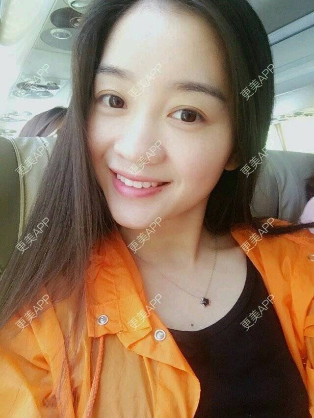 更美 - 彩小文的除皱瘦脸经验 | 注射肉毒素 | 除皱瘦脸 | 瘦脸类 | 北京