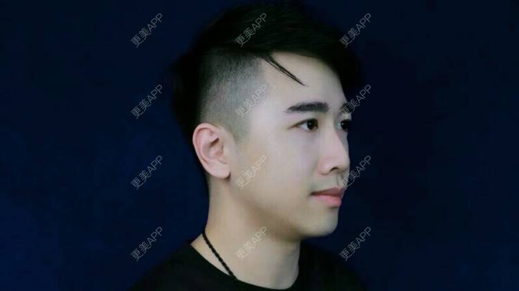 更美 - 网络主播“小俞灏明”的玻尿酸经验 | 广州 | 玻尿酸 | 玻尿酸注射下巴