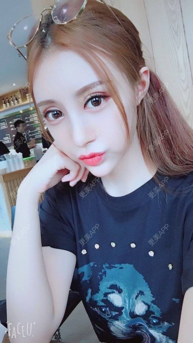 更美 - 小主播网红一枚😊的鼻部多项经验 | 广州 | 双眼皮微创 | 眼部整形 | 鼻部多项