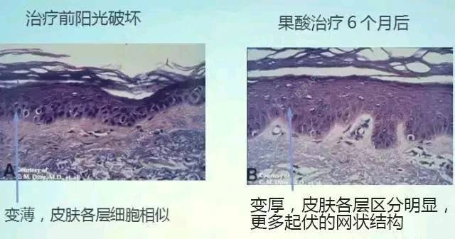 更美 - 蒋安 医生的果酸焕肤经验 | 果酸焕肤 | 成都