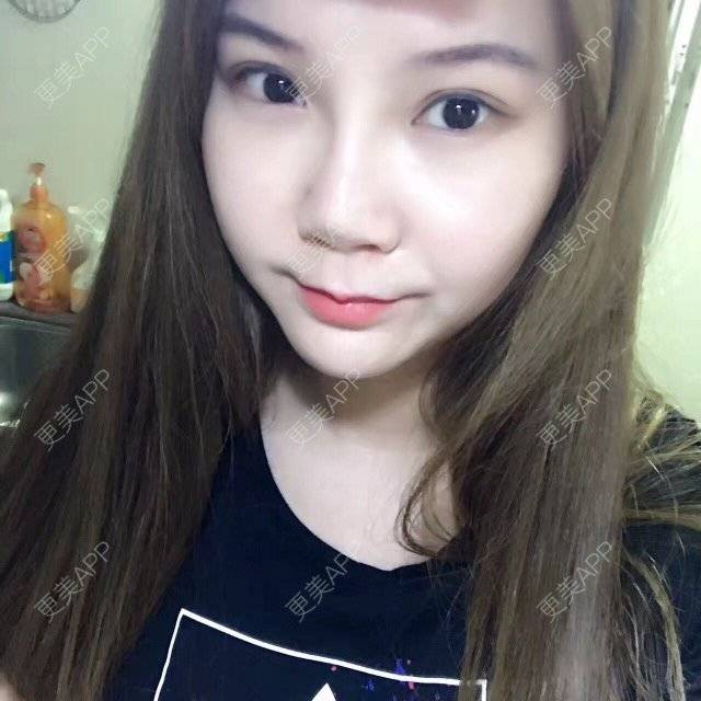 更美 - 普罗旺斯海岸的除皱瘦脸经验 | 注射瘦脸· | 武汉同城 | 除皱瘦脸 | 武汉
