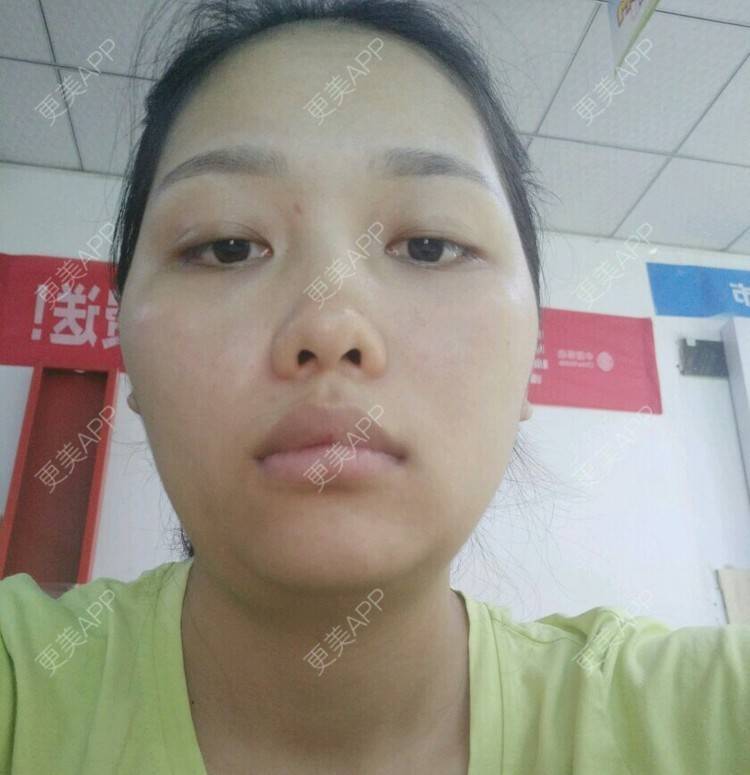 更美 - ʚɞ的经验 | 脸部轮廓 | 重庆