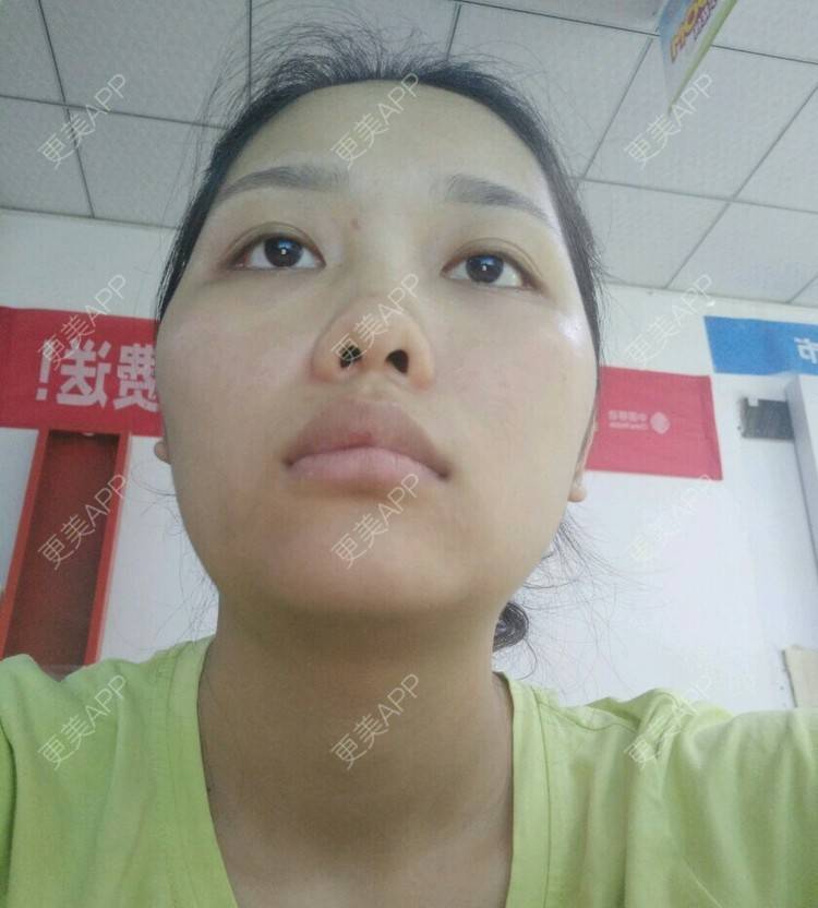 更美 - ʚɞ的经验 | 脸部轮廓 | 重庆