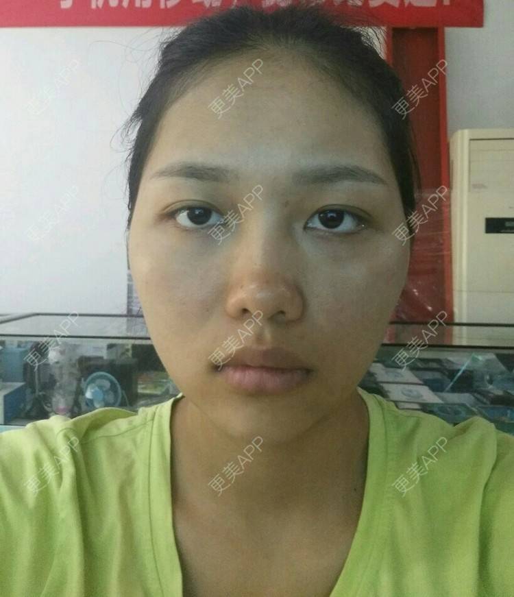 更美 - ʚɞ的经验 | 脸部轮廓 | 重庆