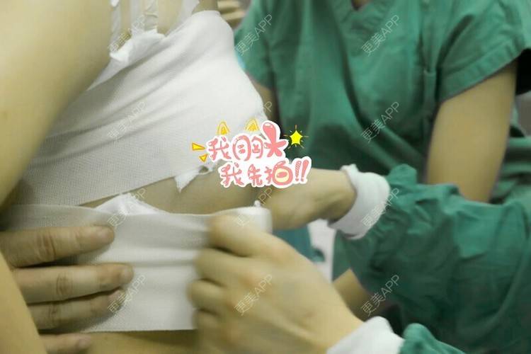 更美 - 小晓姐的假体隆胸经验 | 前卫内窥镜无痕性感丰胸 | 极速丰胸 | 假体隆胸 | 成都