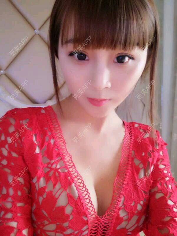 更美 - 小晓姐的假体隆胸经验 | 内窥镜丰胸 | 丰胸美乳 | 假体隆胸 | 自体脂肪丰胸纳米技术 | 成都
