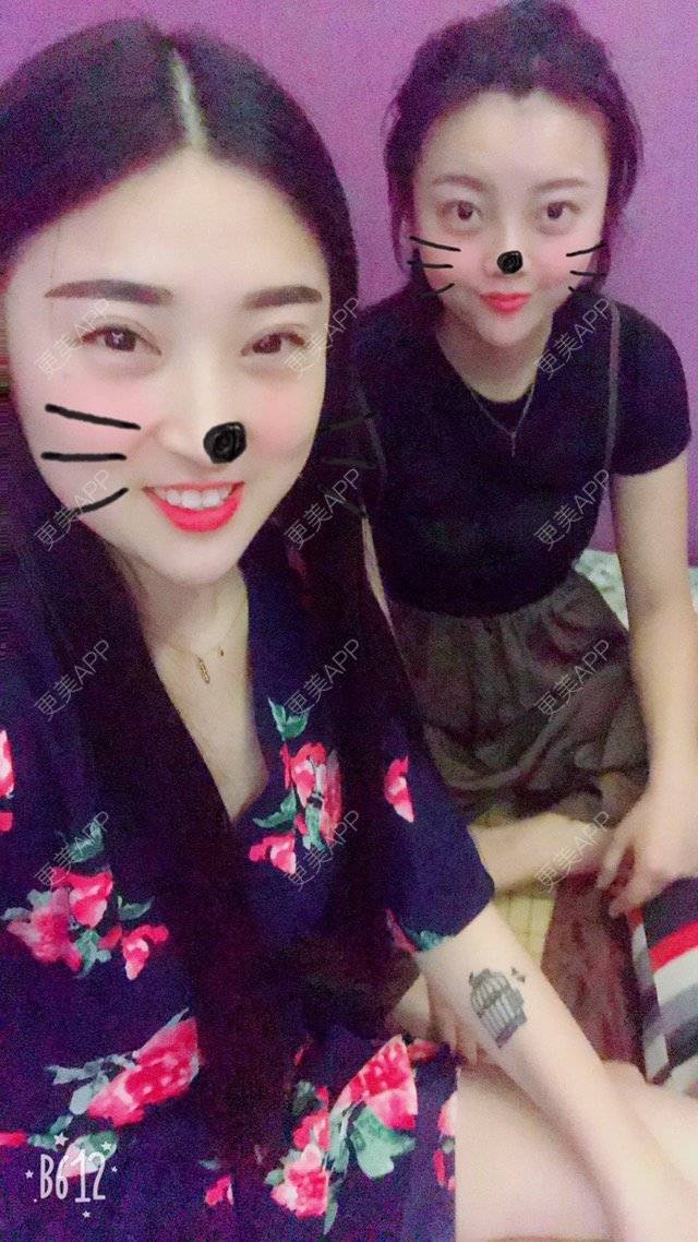 更美 - 鬼迷心窍@的经验 | 眼部整形 | 面部轮廓 | 半永久妆 | 北京