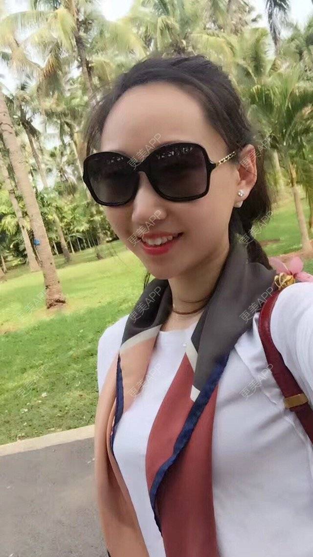 更美 - 洪梁健 医生的膨体垫下巴经验 | 膨体垫下巴 | 重庆