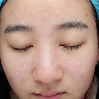 美喵子Padoan