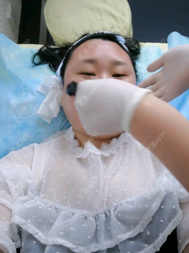 更美 - ✿西伯利亚的蝴蝶✿的小气泡经验 | 北京 | 小气泡 | 微针