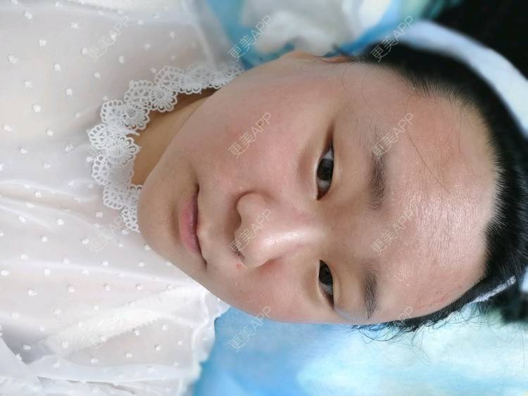 更美 - ✿西伯利亚的蝴蝶✿的小气泡经验 | 北京 | 小气泡 | 微针