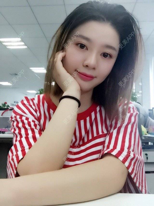 更美 - 唯艺妮子的玻尿酸下巴经验 | 注射美容 | 上海 | 玻尿酸下巴 | 除皱瘦脸