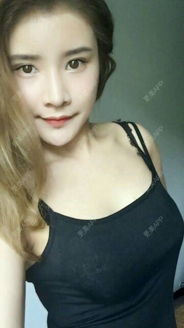 女神经的自体脂肪隆胸日记