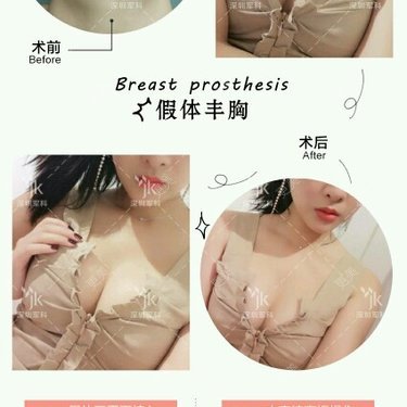 刘月更 医生