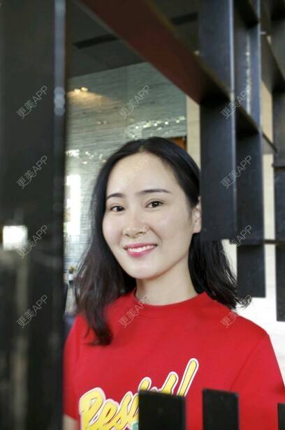 更美 - 春眠倦花的隐形牙齿矫正经验 | 隐适美隐形牙齿矫正 | 牙齿正畸 | 隐形牙齿矫正