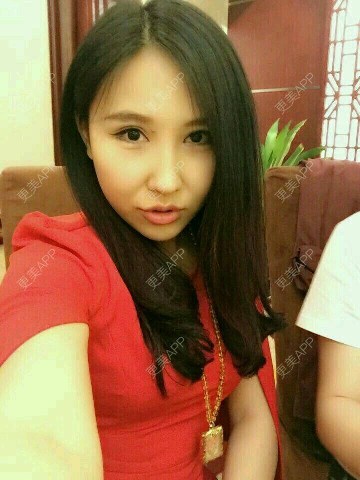 更美 - 撩人心的温柔的经验 | 脸部轮廓 | 想做鼻子 | 北京