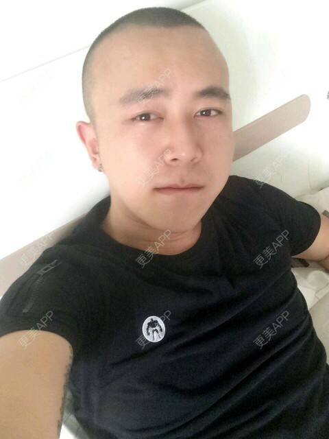 更美 - 王涛 医生的经验 | 耳发种植 | 成都