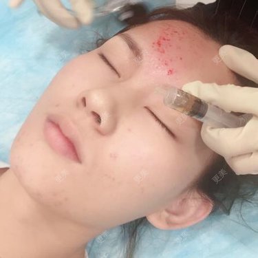 婷鑫宝宝