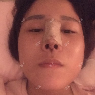 傻微