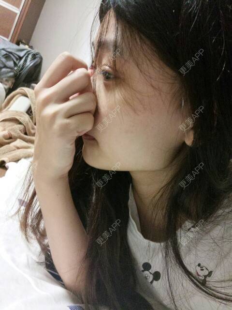 更美 - 你脑海里的鬼的经验 | 假体垫下巴 | 广州