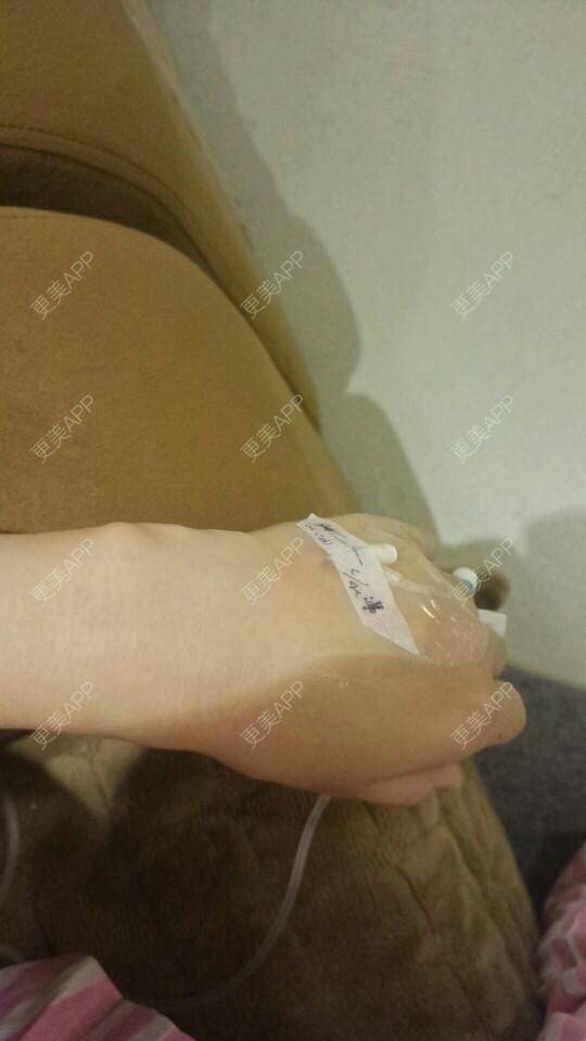 更美 - xiao.yin的经验 | 重庆 | 眉弓脂肪填充 | 大小腿吸脂 | 吸脂瘦大腿