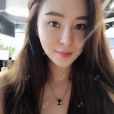 小野欣筒