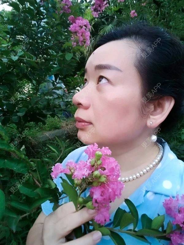 更美 - Dr.丁的超声提升经验 | 超声提升 | 重庆 | 去皱纹 | 极线音波拉皮