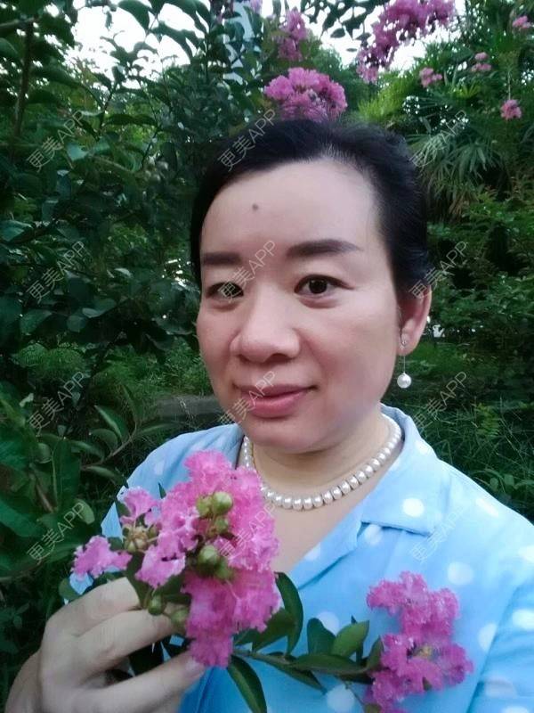更美 - Dr.丁的超声提升经验 | 超声提升 | 重庆 | 去皱纹 | 极线音波拉皮
