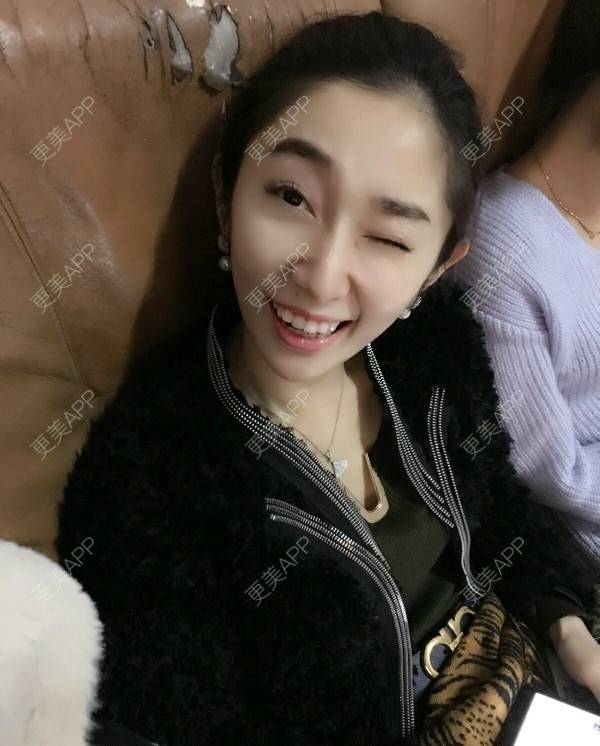 更美 - 更美用户uz9hqyjQmU的淡化皱纹经验 | 抬头纹 | 淡化皱纹 | 鱼尾纹 | 杭州