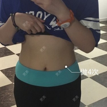 樱桃33