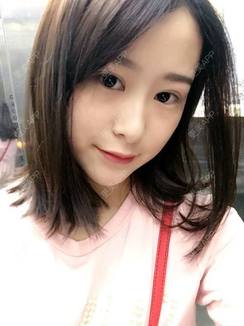 更美 - 腿短猫不吃鱼的玻尿酸下巴经验 | 玻尿酸下巴 | 武汉