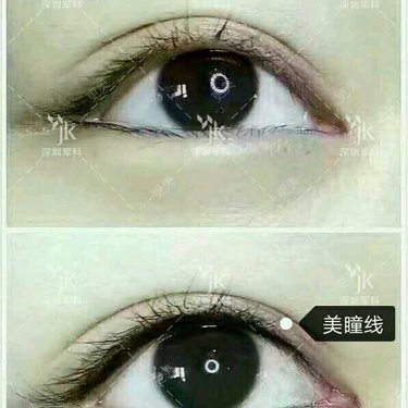 刘月更 医生