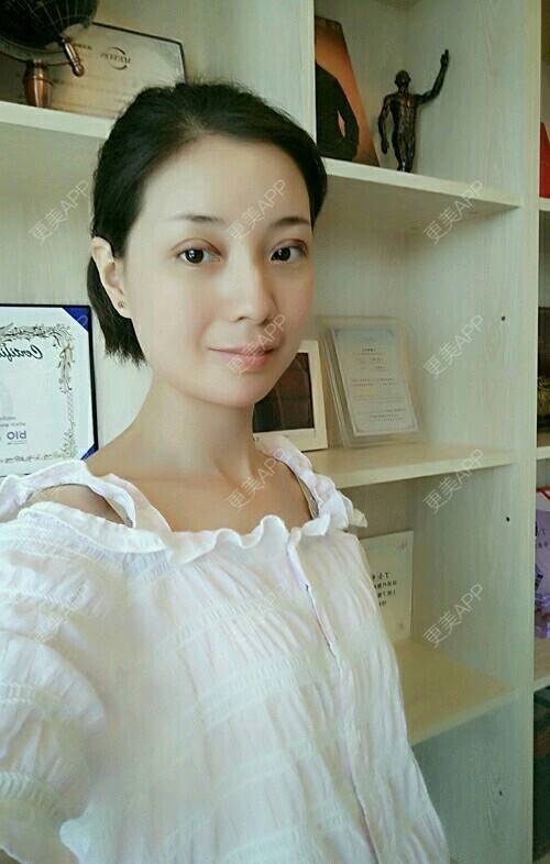 更美 - 郁筱筱的瘦脸除皱经验 | 注射美容 | 瘦脸除皱 | 注射瘦脸· | 西安