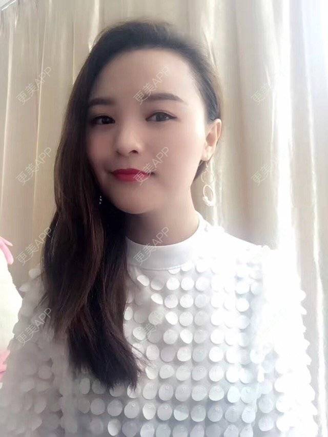 更美 - 木槿、夏的淡化皱纹经验 | 淡化皱纹 | 注射botox除抬头纹 | 面部轮廓. | 深圳