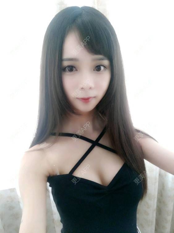更美 - 二次元的我的假体隆胸经验 | 水滴形假体隆胸 | 胸部塑身 | 假体隆胸 | 成都