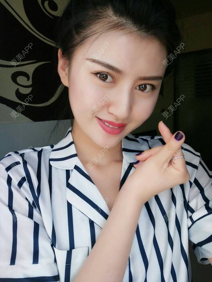 更美 - 文娇😁的皮肤综合管理套餐经验 | 成都 | 皮肤综合管理套餐 | 成都智悦美容 | 美容护肤