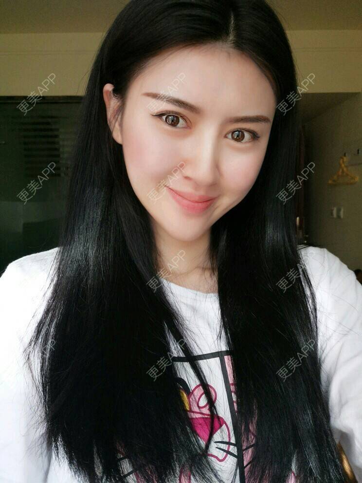 更美 - 文娇😁的皮肤综合管理套餐经验 | 成都 | 皮肤综合管理套餐 | 成都智悦美容 | 美容护肤