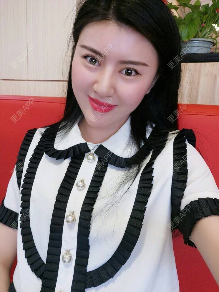 更美 - 文娇😁的皮肤综合管理套餐经验 | 成都 | 皮肤综合管理套餐 | 成都智悦美容 | 美容护肤