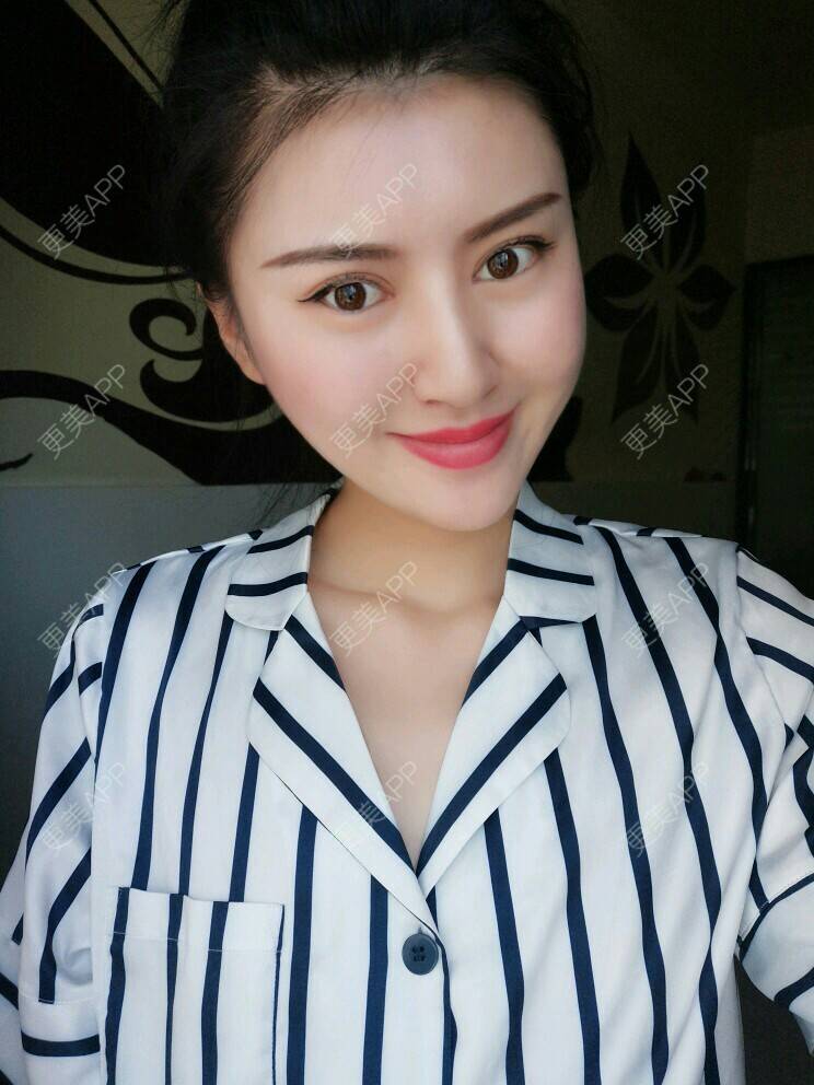 更美 - 文娇😁的皮肤综合管理套餐经验 | 成都 | 皮肤综合管理套餐 | 成都智悦美容 | 美容护肤