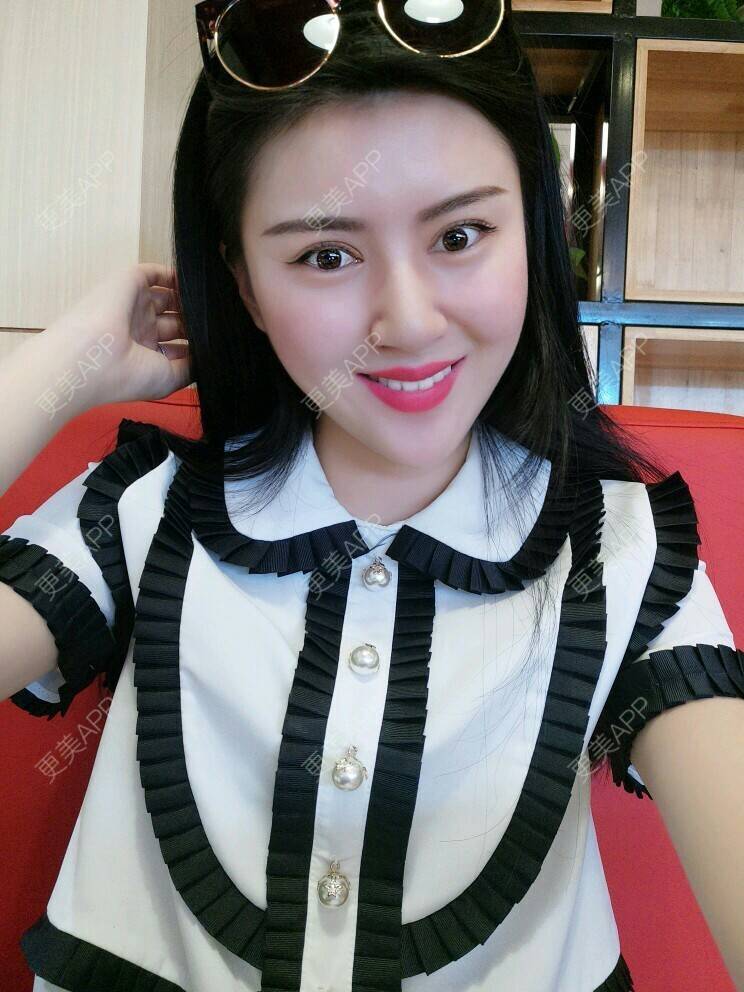 更美 - 文娇😁的皮肤综合管理套餐经验 | 成都 | 皮肤综合管理套餐 | 成都智悦美容 | 美容护肤