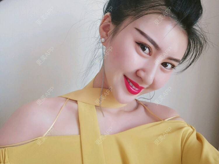 更美 - 文娇😁的皮肤综合管理套餐经验 | 成都 | 皮肤综合管理套餐 | 成都智悦美容 | 美容护肤