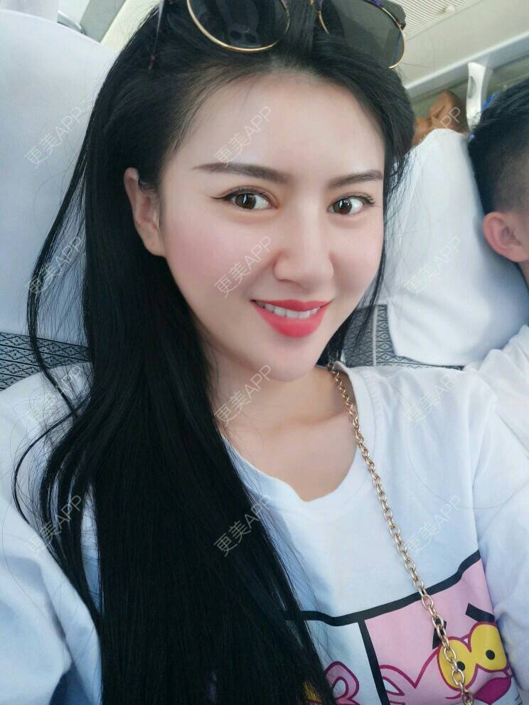 更美 - 文娇😁的皮肤综合管理套餐经验 | 成都 | 皮肤综合管理套餐 | 成都智悦美容 | 美容护肤