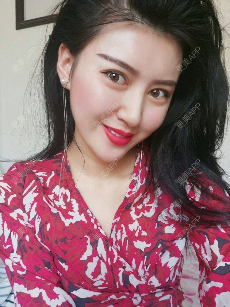 更美 - 文娇😁的皮肤综合管理套餐经验 | 成都 | 皮肤综合管理套餐 | 成都智悦美容 | 美容护肤