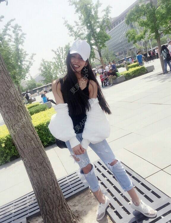 更美 - 我最靠谱儿的手臂脱毛经验 | 上海 | 手臂脱毛