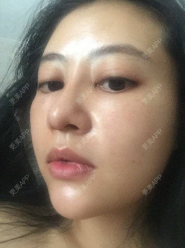 更美 - 岚城的经验 | 成都 | 清洁补水 | 抗衰老 | 皮肤综合管理