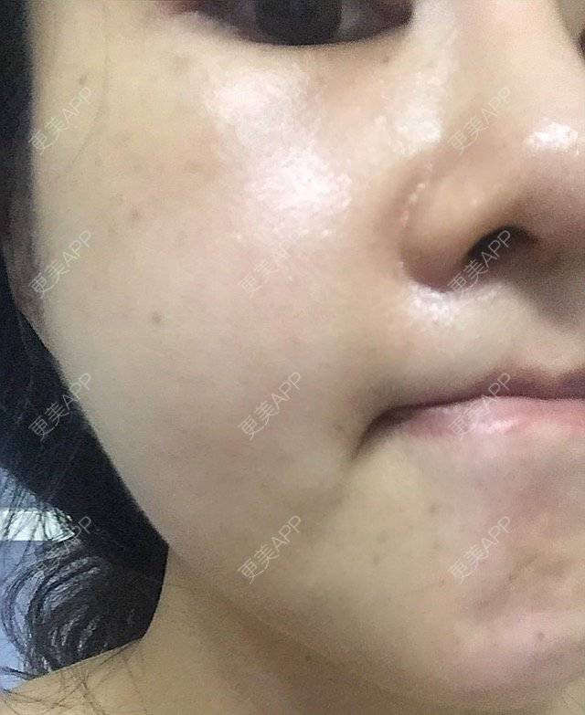 更美 - 岚城的经验 | 成都 | 清洁补水 | 抗衰老 | 皮肤综合管理
