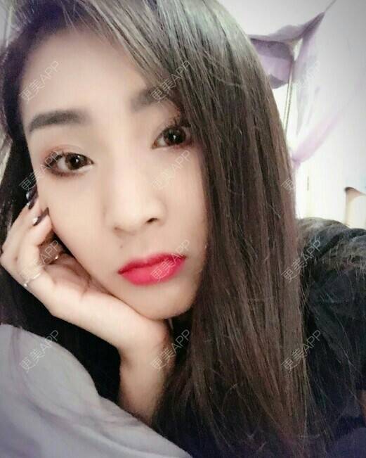 更美 - 我最靠谱儿的手臂脱毛经验 | 上海 | 手臂脱毛