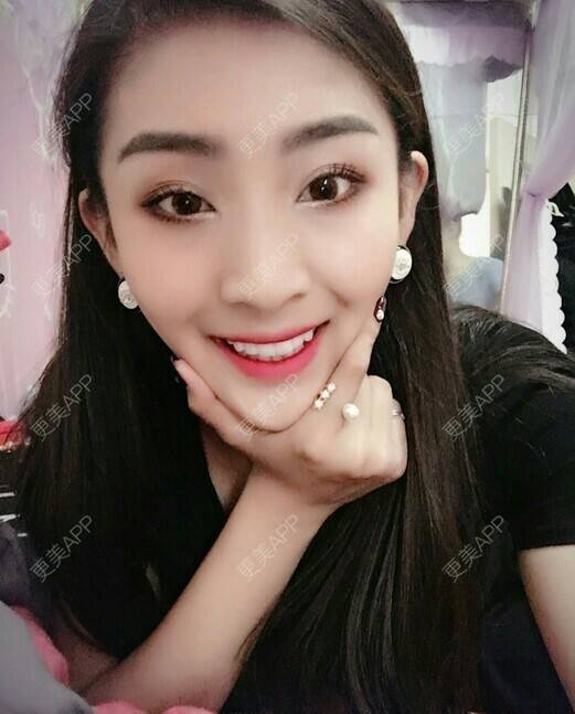 更美 - 我最靠谱儿的手臂脱毛经验 | 上海 | 手臂脱毛