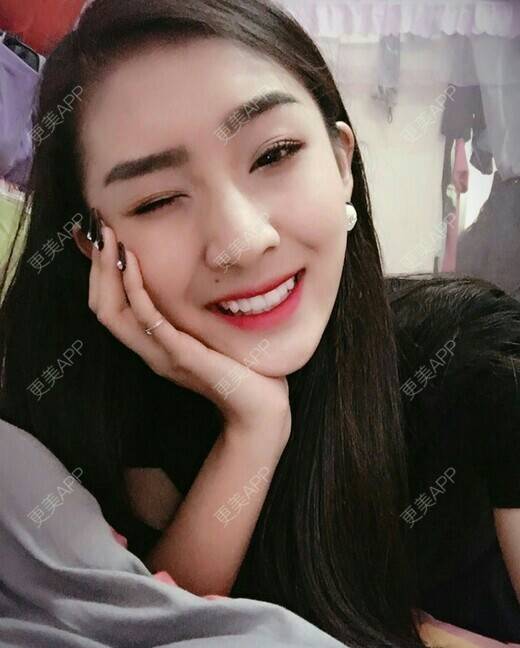 更美 - 我最靠谱儿的手臂脱毛经验 | 上海 | 手臂脱毛